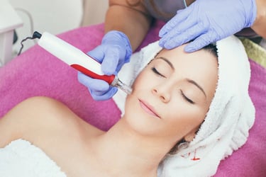 Microneedling at Vesna Beauty Spa