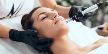 Microneedling at Vesna Beauty Spa